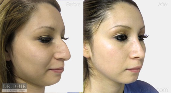 nose2