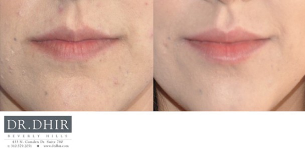 Lips-41