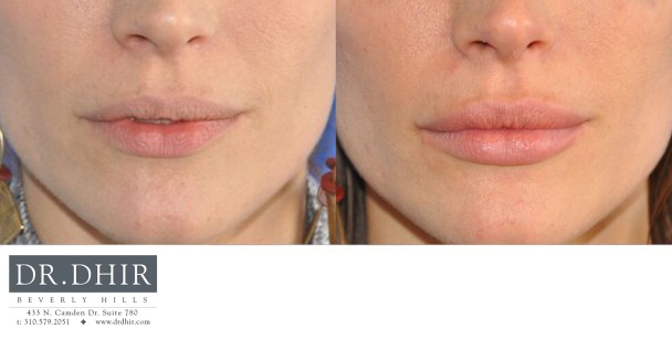 Lips-8-1