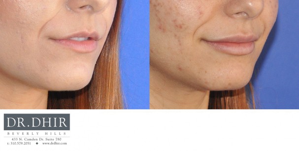 drdhir-lips-25-2