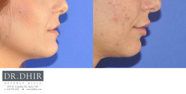 drdhir-lips-25-3