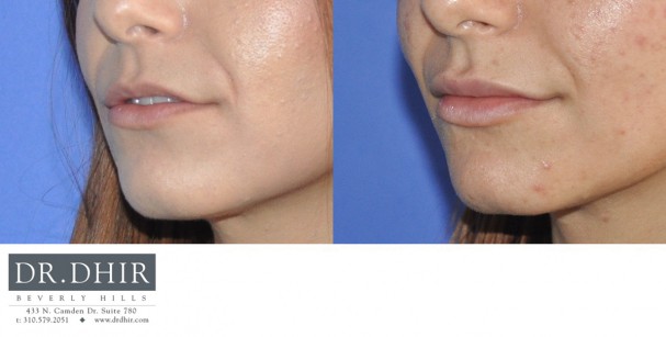 drdhir-lips-25-4