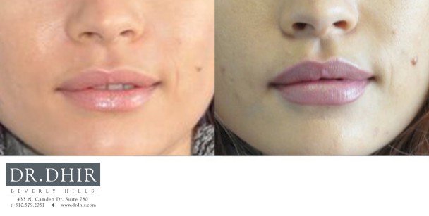 lips-7-3