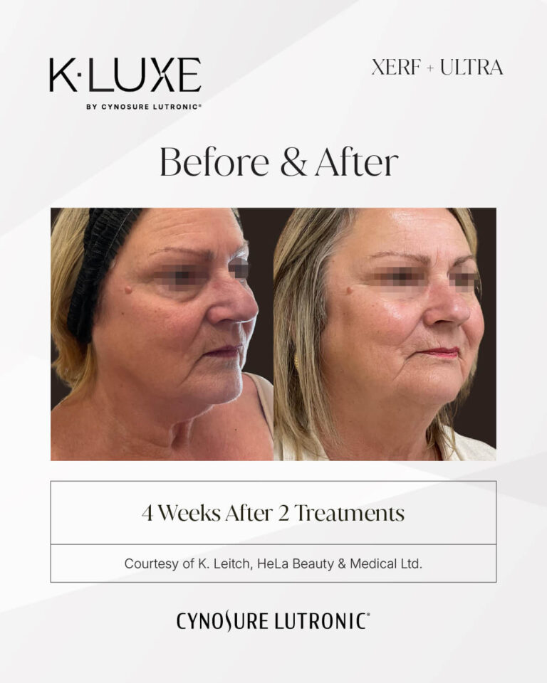 4542533775-K-LUXE-Hela-Beauty-CIS-049-051-BNA-Format-IG-1080x1350-02