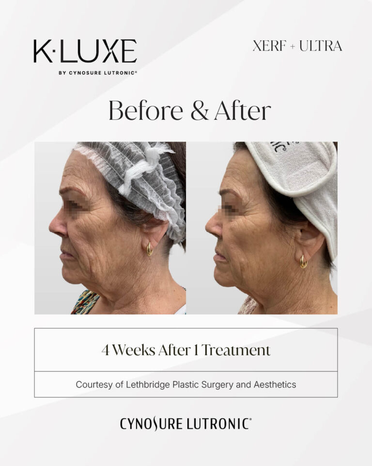 4542548162-K-LUXE-Hela-Beauty-CIS-042-058-BNA-Format-IG-1080x1350-02