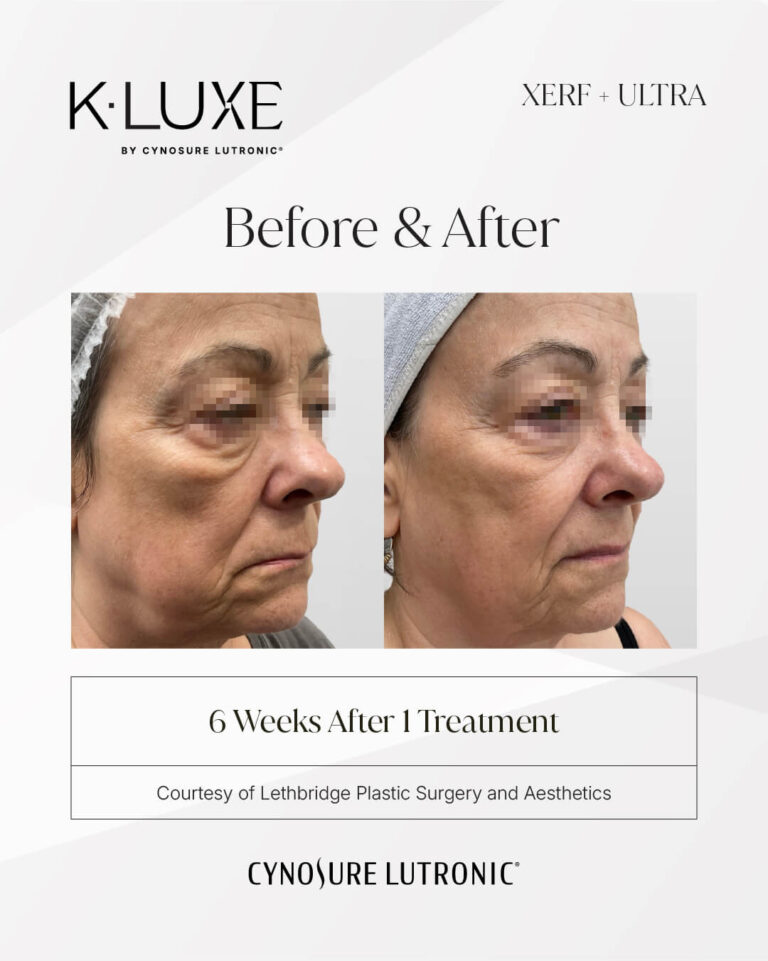 4542548162-K-LUXE-Hela-Beauty-CIS-042-058-BNA-Format-IG-1080x1350-05