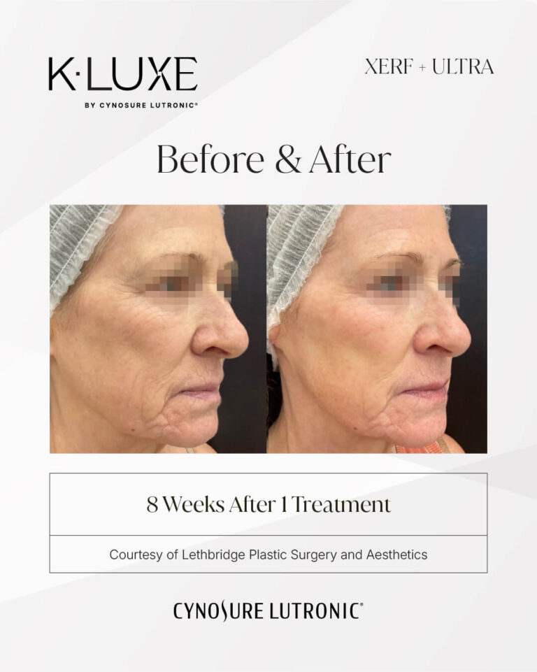4542548162-K-LUXE-Hela-Beauty-CIS-042-058-BNA-Format-IG-1080x1350-06
