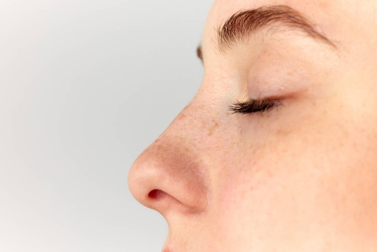 Featured image for 8 Things to Know Before Your Rhinoplasty