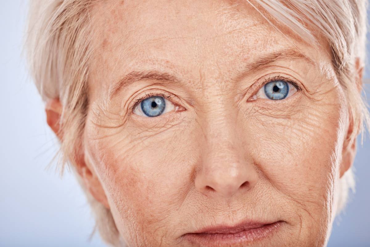 Featured image for Can a Facelift Eliminate Wrinkles