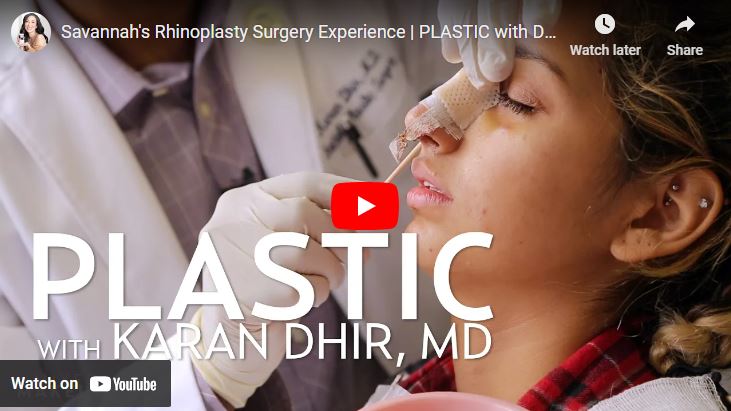 Thumbnail of Savannah's Rhinoplasty surgery experience with Dr Dhir's video